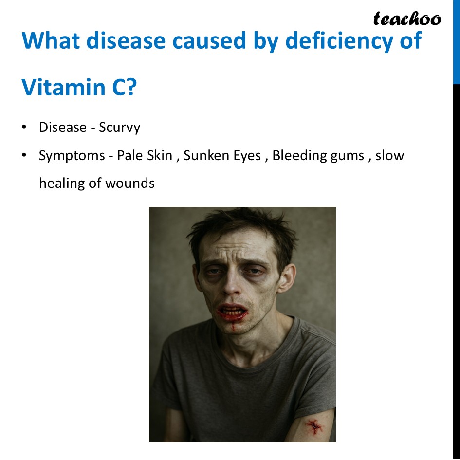part 24 - Different Components of Food - Concepts - Chapter 3 Class 6 - Mindful Eating: A path to healthy body (Curiosity) - Class 6