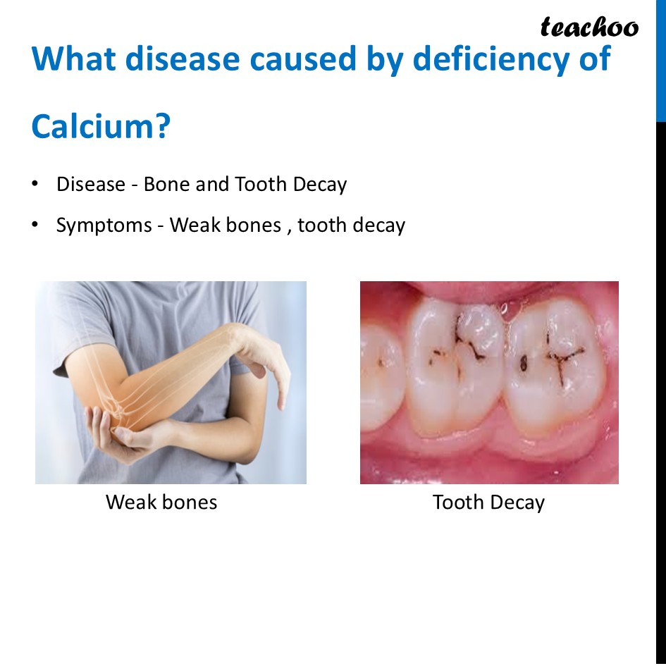 part 29 - Different Components of Food - Concepts - Chapter 3 Class 6 - Mindful Eating: A path to healthy body (Curiosity) - Class 6