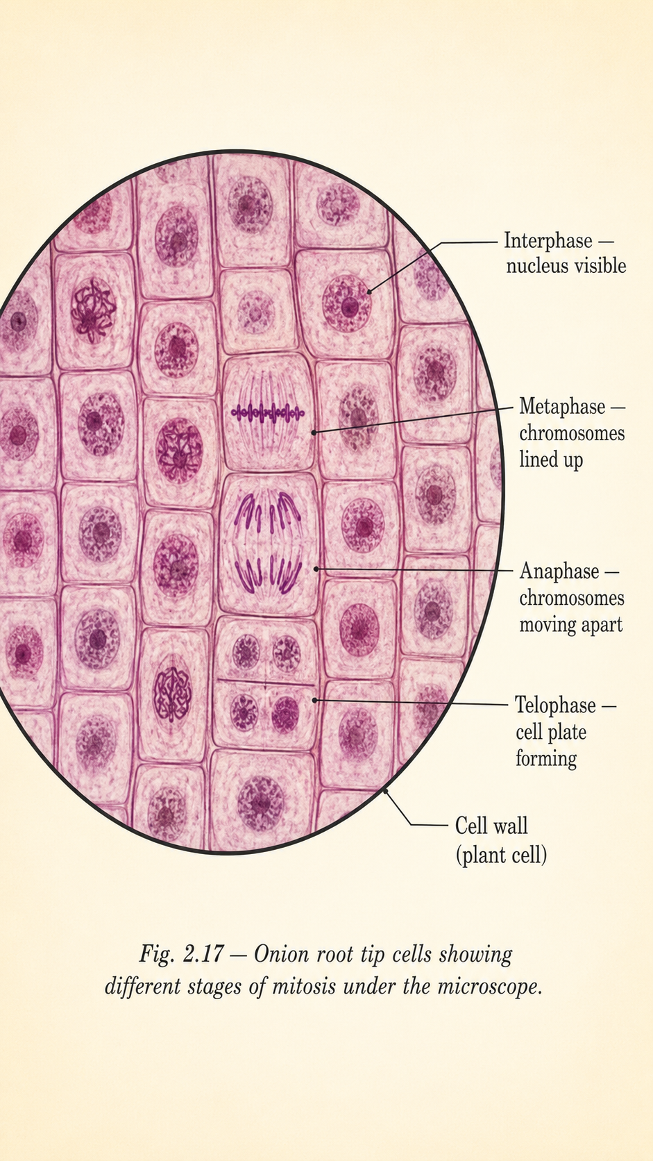 Image: A microscope view of onion root tip cells showing several cells at different stages of cell division, some with visible thread-like chromosomes and others with a clear nucleus.