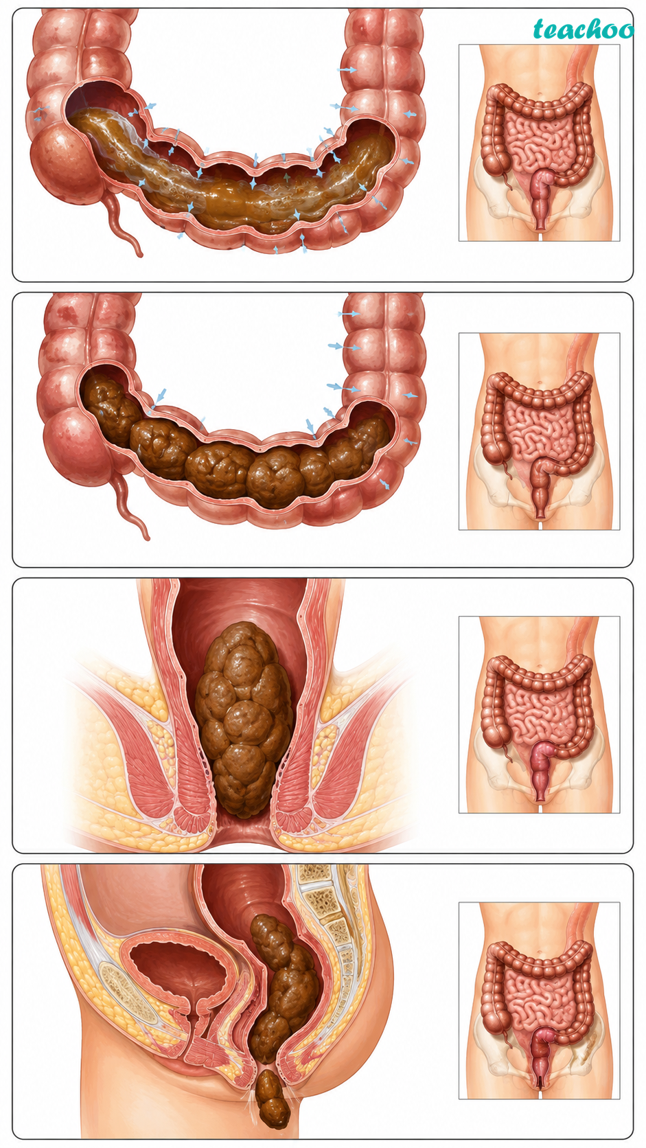 part 10 - 9.1.1 Digestion in Human Beings - Concepts - Chapter 9 Class 7 - Life Processes in Animals (Curiosity) - Class 7 (Curiosity)